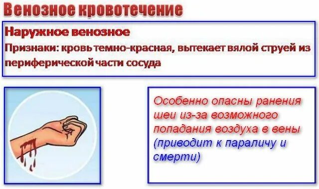 Как остановить обильное кровотечение тест. Остановка венозного кровотечения. Венозная кровотичение. Способы остановки венозного кровотечения. Остановка при венозном кровотечении.