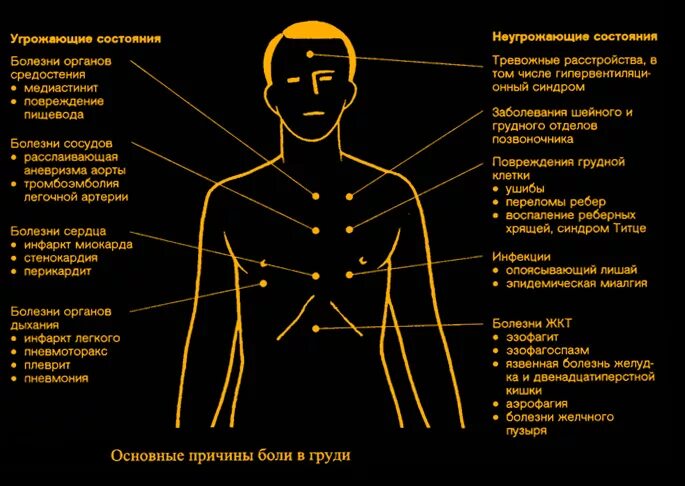 Колет означает. Колющие боли в груди слева. Болит в грудине с правой стороны.