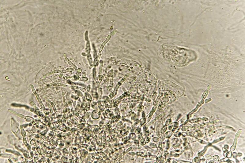 Дрожжевые клетки в моче повышены. Дрожжи кандида под микроскопом. Кандида альбиканс под микроскопом. Candida Auris микроскопия.