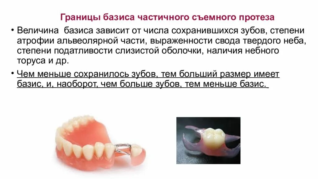 Сотрудники базиса. Границы базиса ЧСПП. Границы базиса съемного пластинчатого протеза. Границы частичного съемного протеза.