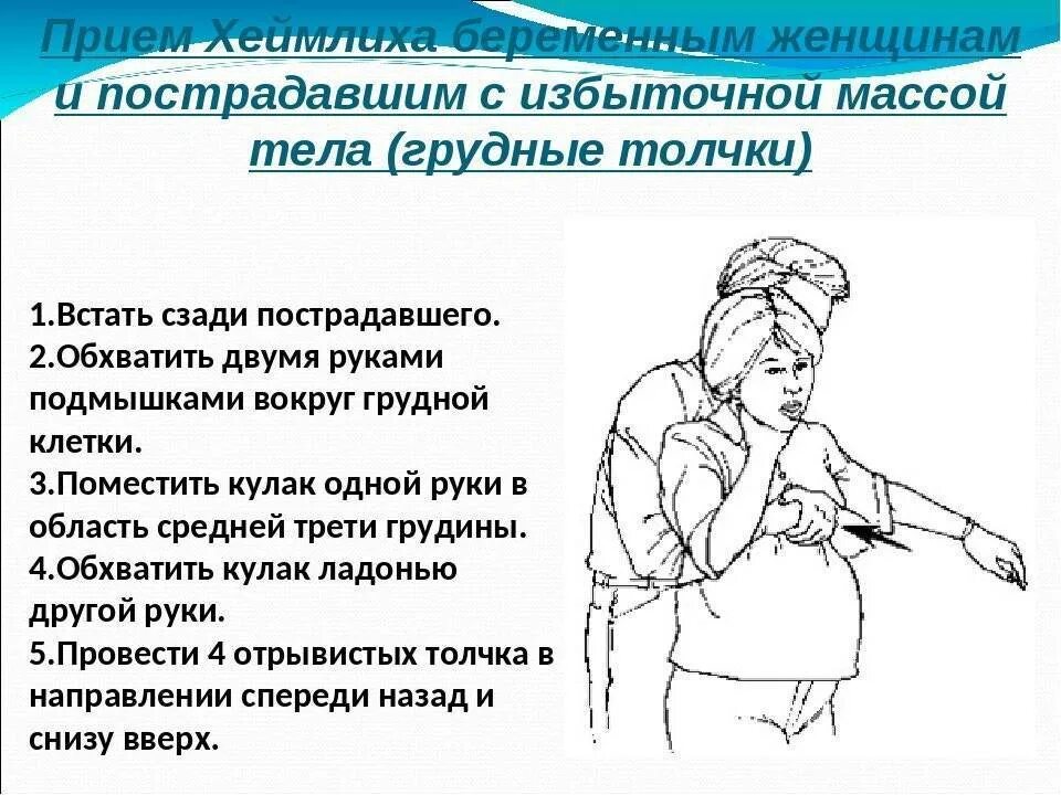 Прием геймлиха при обструкции. Прием хеймлиха. прием геймлиха. приём геймлиха у детей. приём хеймлиха алгоритм.