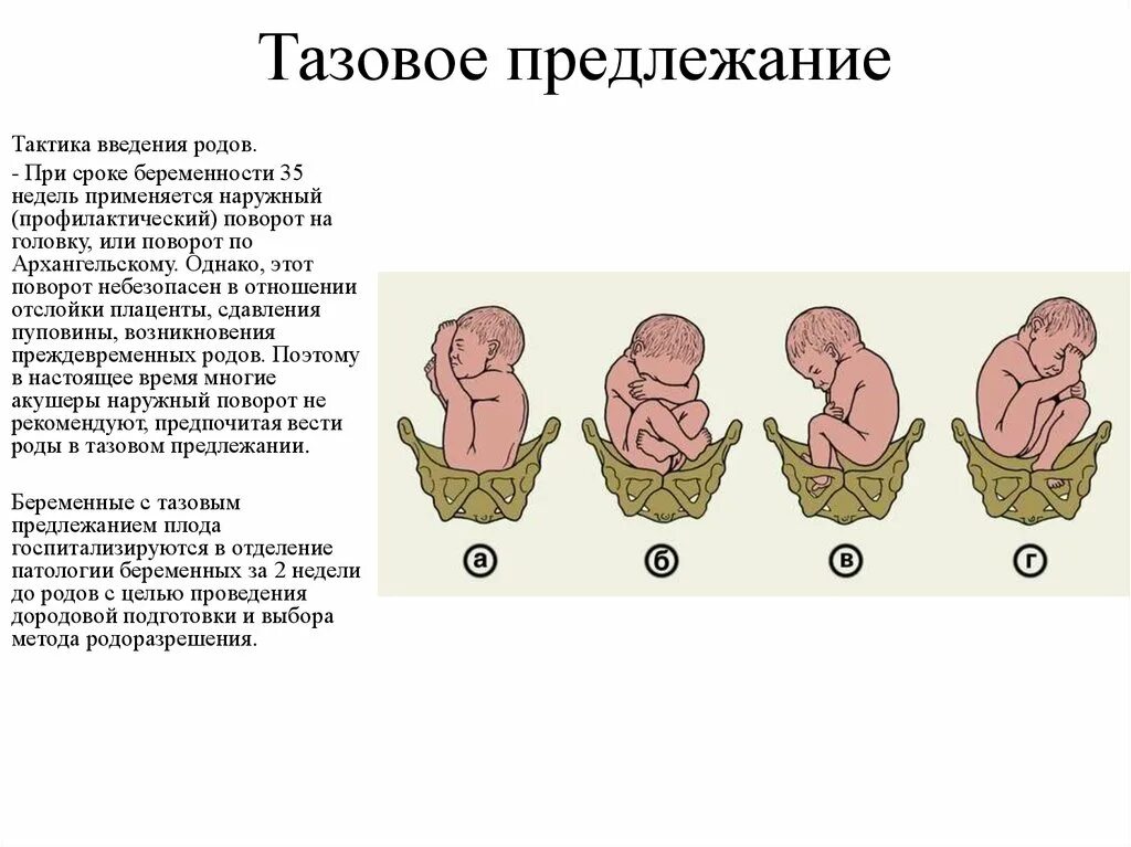 32 недели схватки