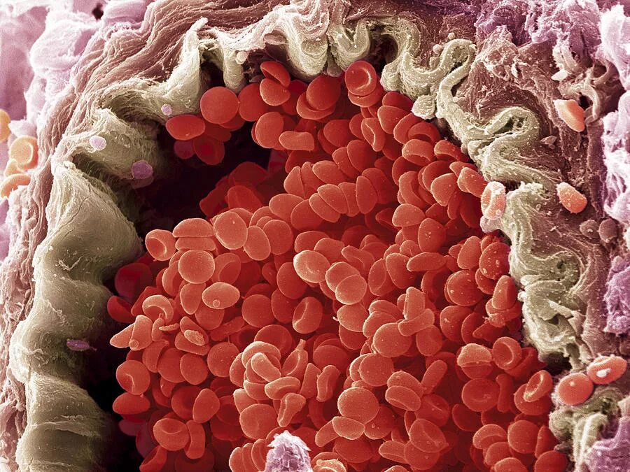 Эритроцит микроскоп. Red blood cell под микроскопом. эритроциты под микроскопом. кровяные тельца под микроскопом. гемоглобин под микроскопом.