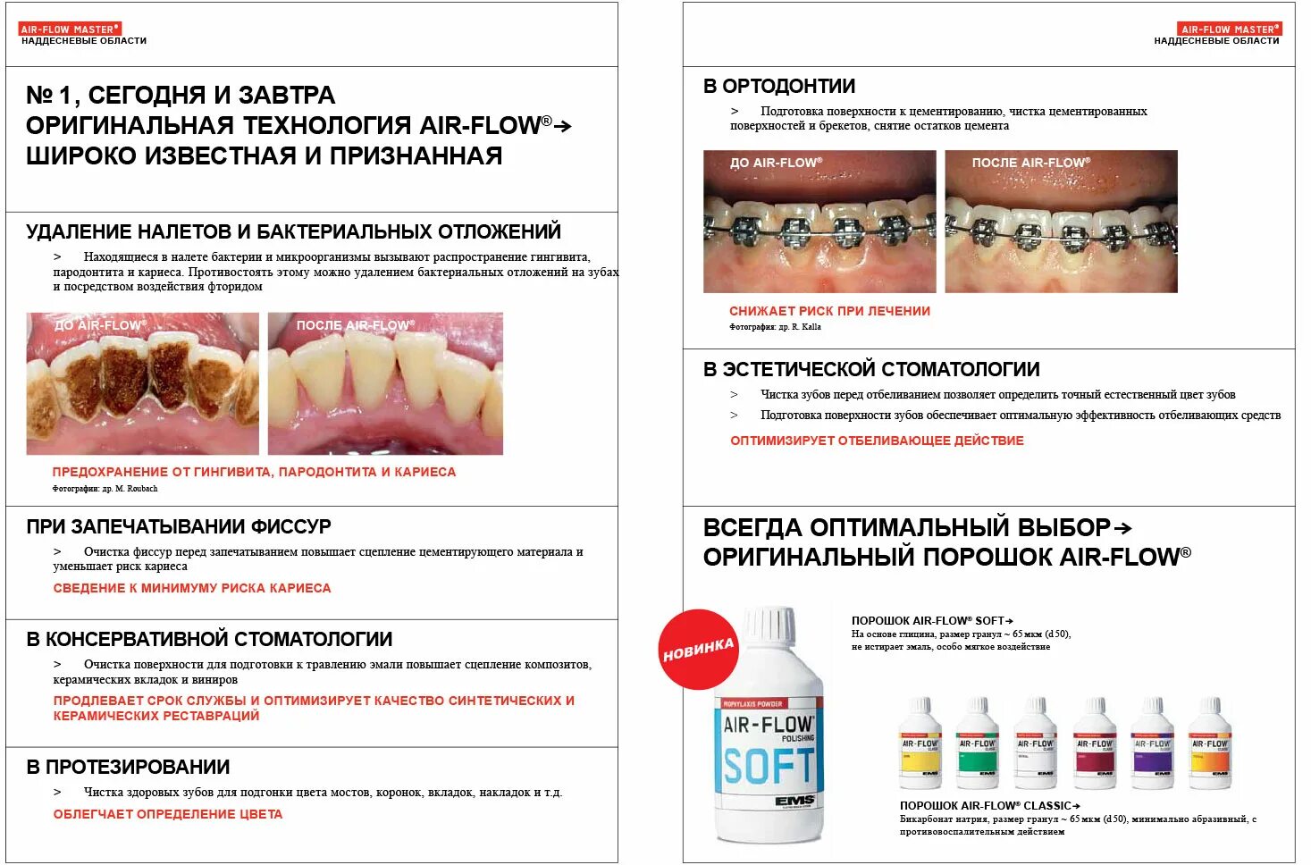 Сколько нельзя пить после чистки. Аппарат Эйр флоу в стоматологии. Методы профессиональной гигиены полости рта. Профессиональная чистка зубов этапы.