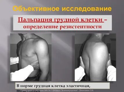 Пальпация грудины