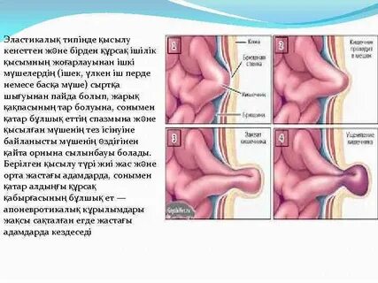 Есектің арасындағы мүше