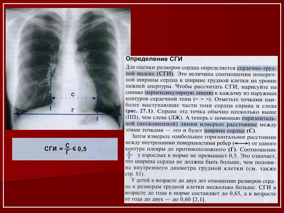 ОГК при рентгене. Рентгенограмма ОГК. Рентген исследование грудной клетки. Рентген ОГК описание норма. Какие легкие в норме