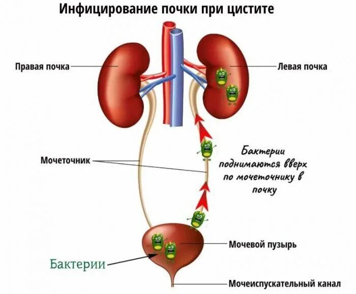 Может ли болеть одна почка. Пути попадания инфекции в почки при пиелонефрите. Пиелонефрит уриногенный путь. Пиелонефрит почки этиология. Почки мочеточник мочевой пузырь схема расположения.