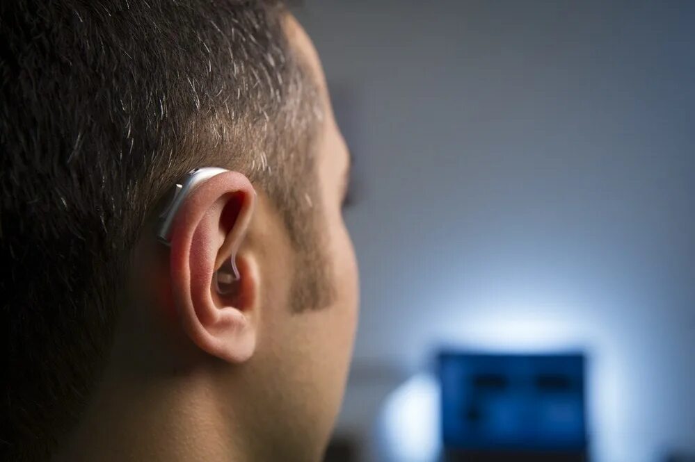 Signia слуховые аппараты. Внутриушные слуховые аппараты отикон. Oticon hearing aids. Oticon hearing aids. Пхонак слуховые аппараты.