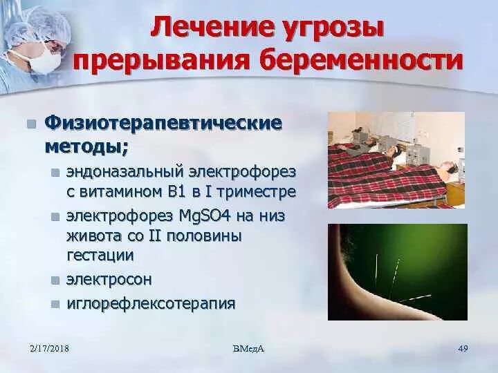 Мкб 10 угроза прерывания. Терапия угрозы прерывания беременности. Электрофорез эндоназально с витамином в1. Эндоназальный электрофорез методика. Эндоназальный электрофорез с витамином в1 показания.