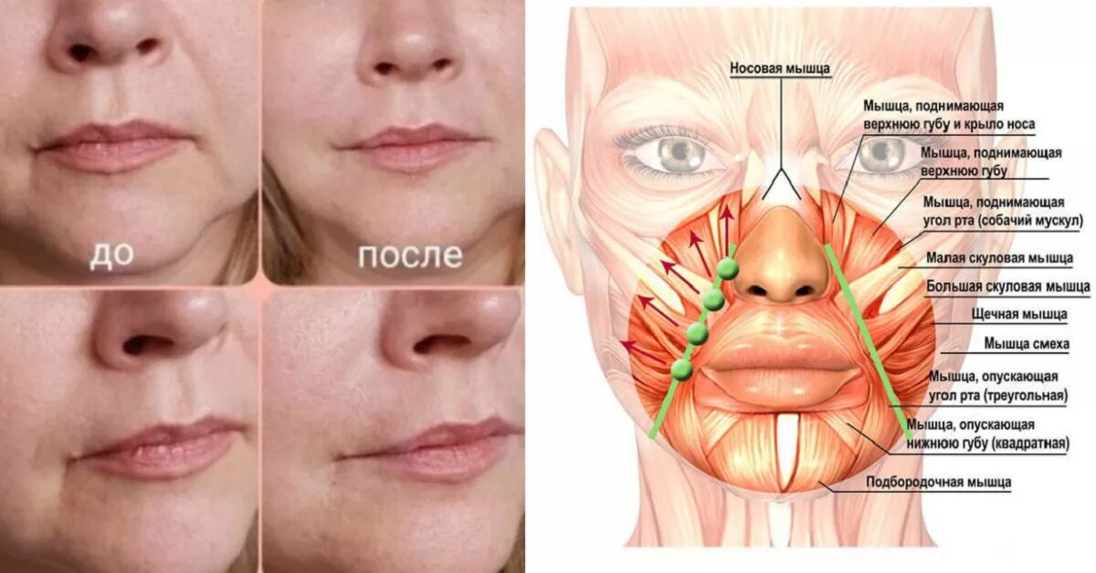 Почему дергается щека. Носогубные складки. Мышцы носогубных складок. Носогубная складка мышцы. Мышцы лица носогубные складки.