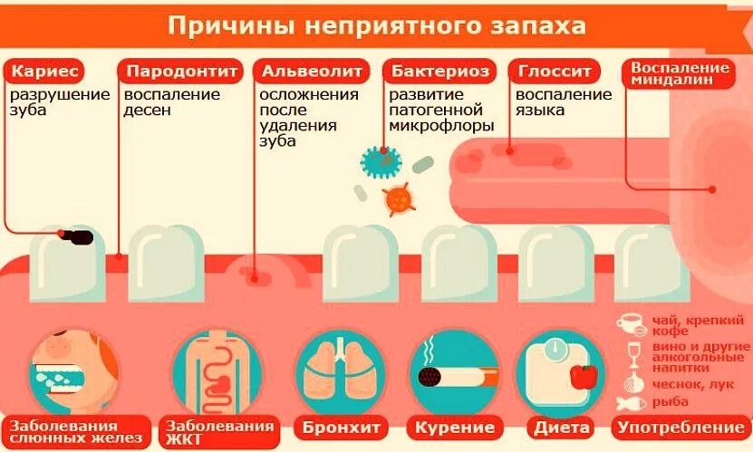 Причины гнилостного запаха изо рта у взрослых. Запах изза РТВ причинф. Неприятный запах изо рта причины. Причтнв запаха изо РТП.