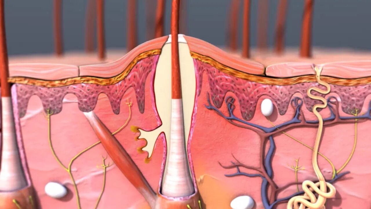 Пробуждение волосяных луковиц. Фолликулит волосяного фолликула. Воспаление сального фолликула. Закупорка сальной фолликулы.