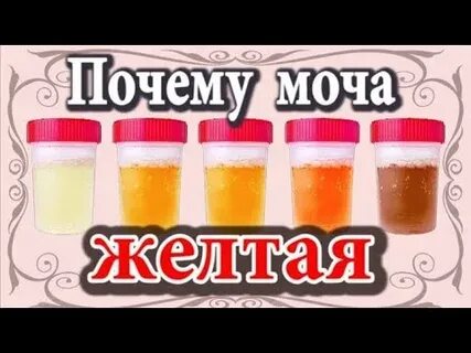 Почему моча желтая зеленая