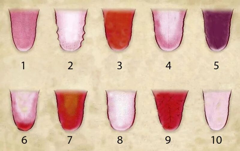 Заболевания по цвету языка. Налет на языке здорового человека. Нормальный цветы языка. Какой должен быть цвет половых