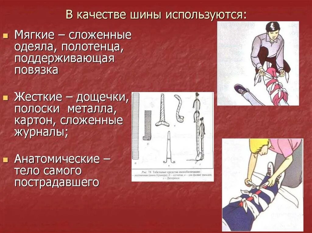 Урок обж травмы. Оказание первой помощи при травмах опорно-двигательной системы. Иммобилизация при травмах опорно двигательного аппарата. Оказание помощи при различных видах травм. Оказание первой помощи при ранениях.