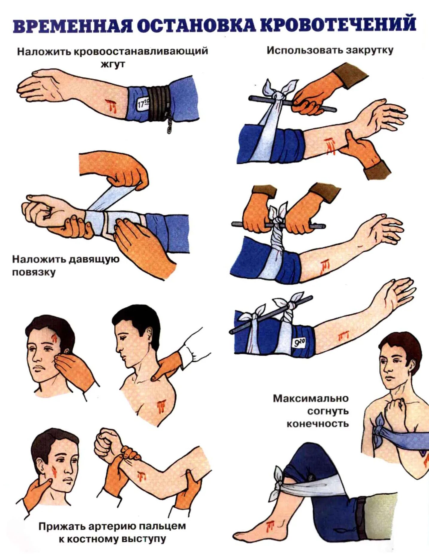 Порядок оказания первой помощи при остановке кровотечения. Методы остановки кровотечения при ранении. Остановка кровотечения при травме конечностей. Способы временной остановки кровотечения наложение повязки. Максимальное непрерывное наложение жгута