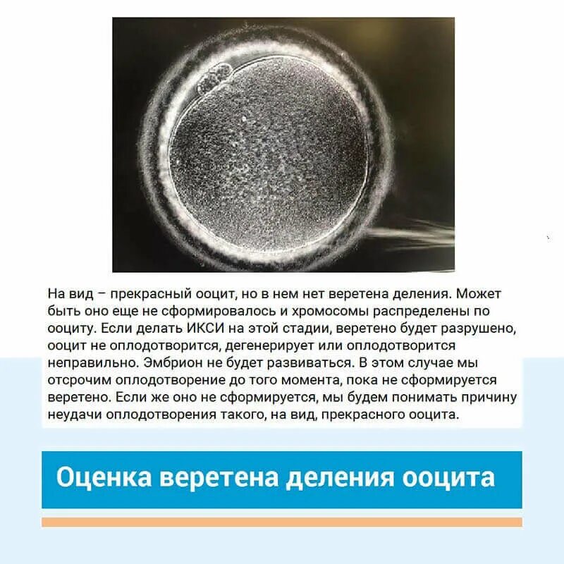 Что значит ооциты