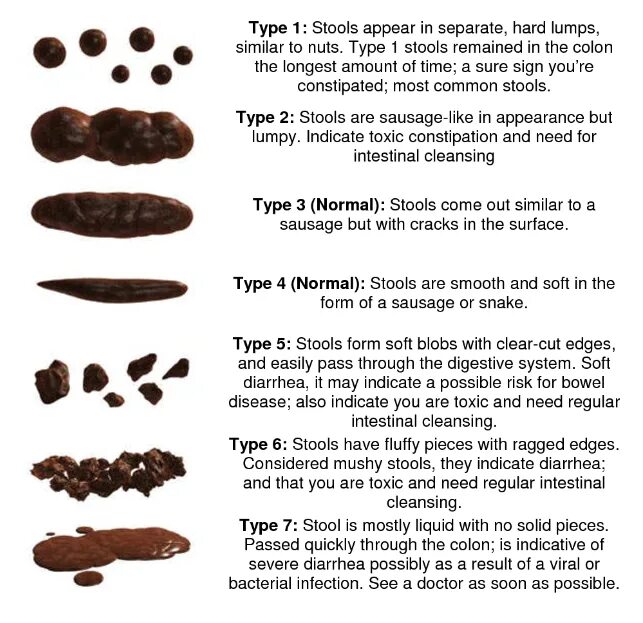 Какого цвета нормальный кал у человека. Нормальный цвет кала человека. Цвет фекалий.