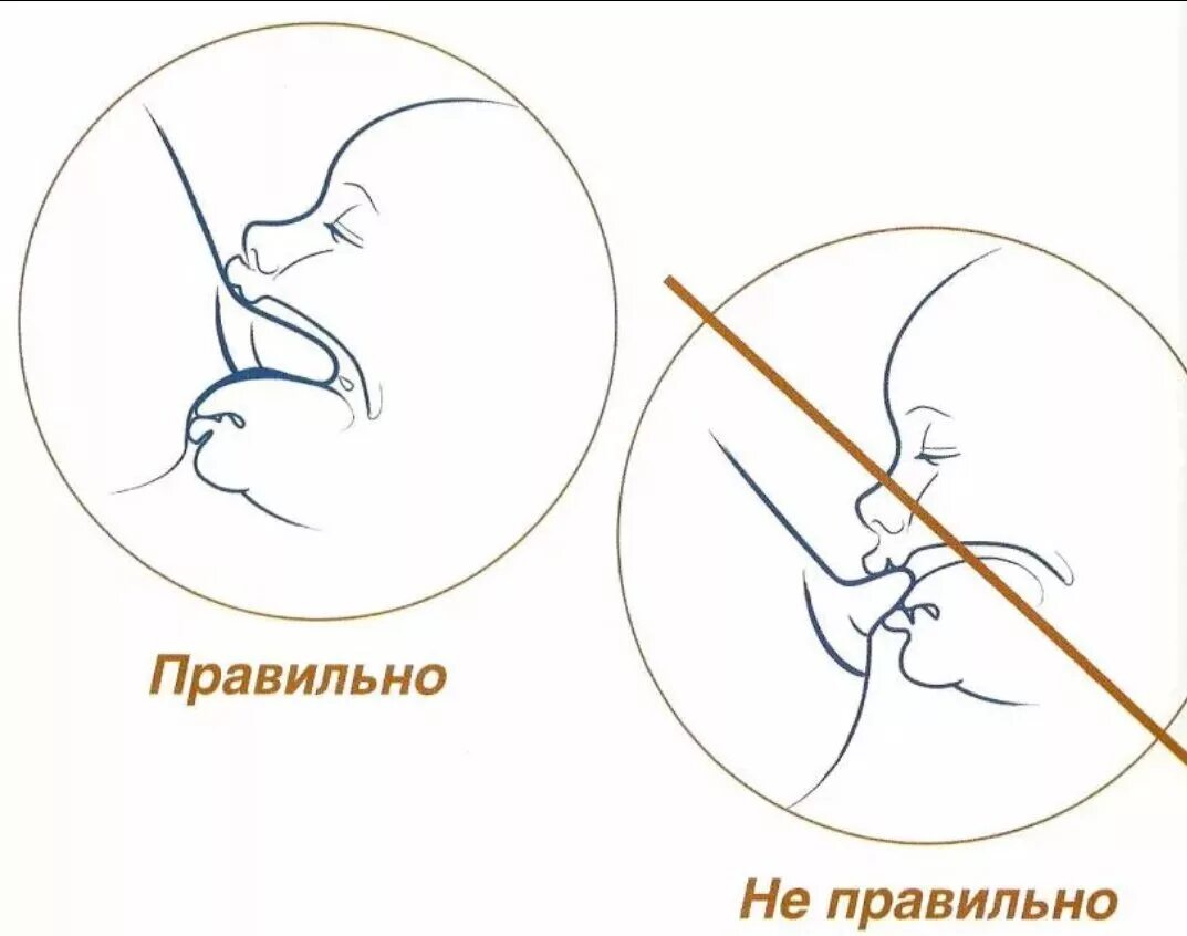 Правильное прикладывание при кормлении грудью. Правильное прикладывание новорожденного ребенка к груди. Правильный захват при грудном вскармливании новорожденного ребенка. Правильное прикладывание ребенка при грудном вскармливании.
