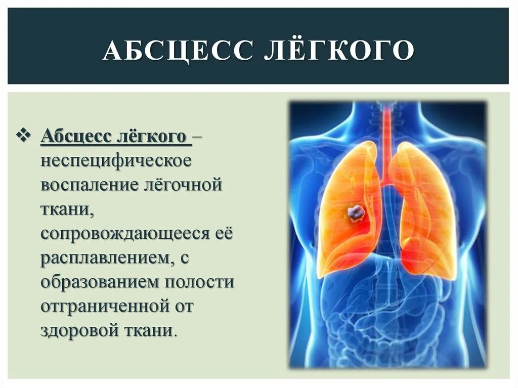 Гнойные абсцессы легких. Абсцесс легкого гнойное расплавление. Абсцесс легких презентация. Хронический абсцесс легкого презентация.