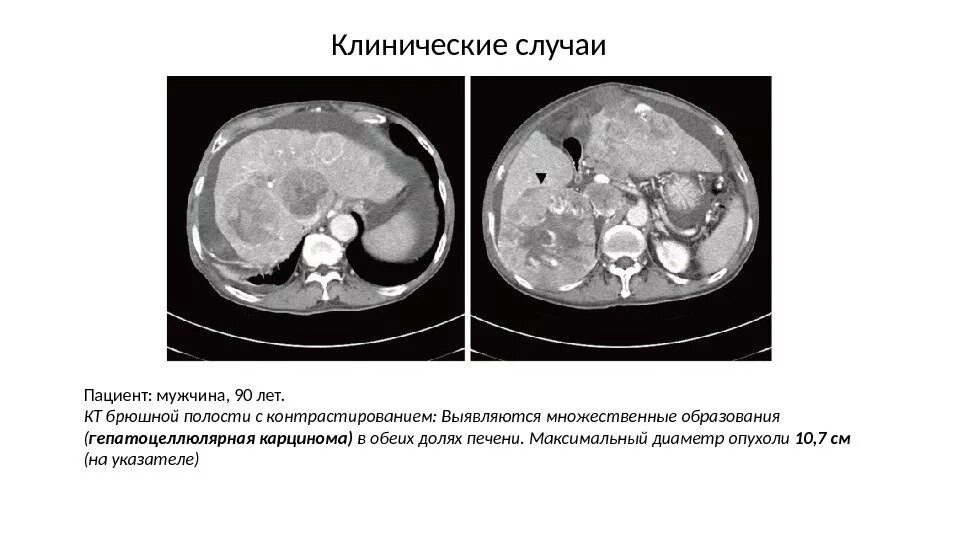 Образование кт