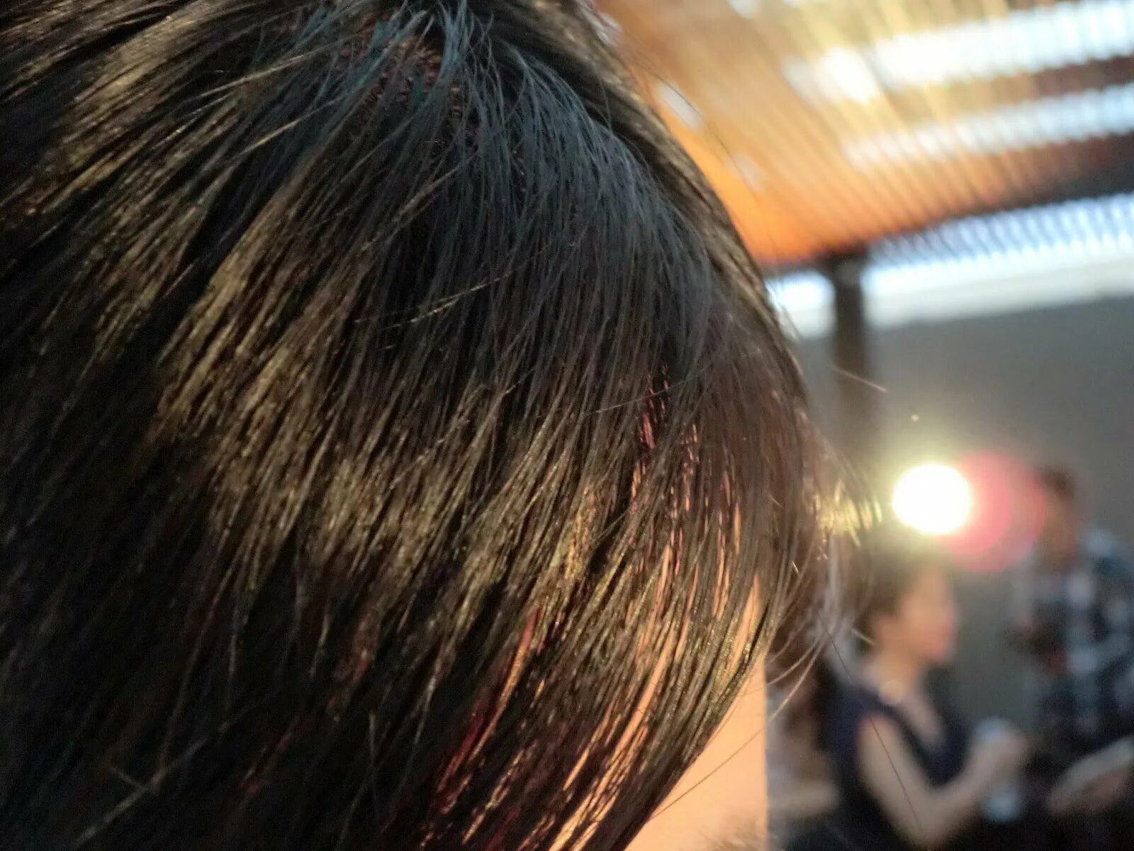 Грязные волосы. Как выглядит грязная голова. Сальные волосы. Грязные волосы. Жирные волосы.