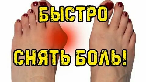 Снять подагру быстро