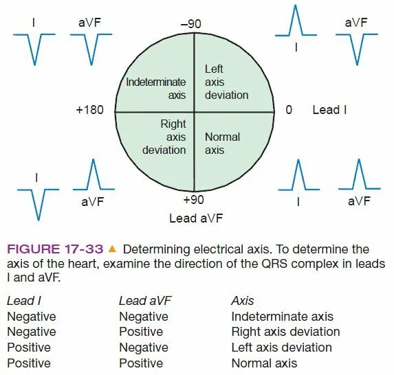 Axis значение. Heart axis. electrical axis of the heart. qrs axis. axis of heart parameters.