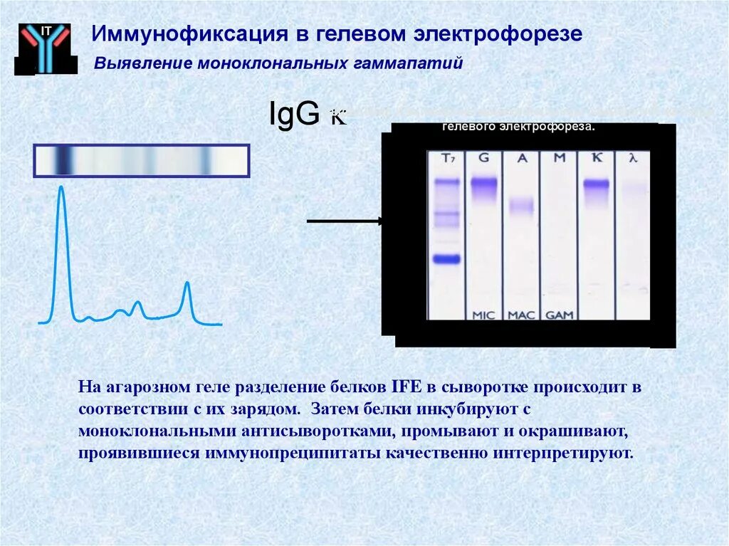 Электрофорез на дне