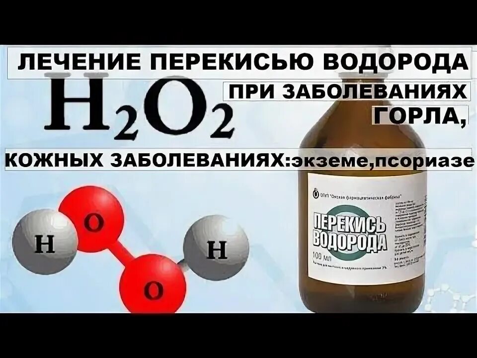 Пью перекись форум. Лечимся перекисью водорода. перекись водорода при кожных заболеваниях. лечение болезни паркинсона перекисью водорода. пить перекись водорода.