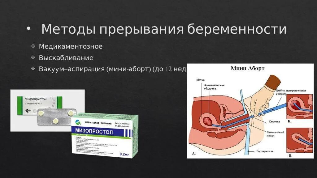 Кровь после выскабливания матки. Методы прерывания беременности. Мини-аборт (вакуум-аспирация). Хирургические методы аборта. Вакуум аспирация методика.