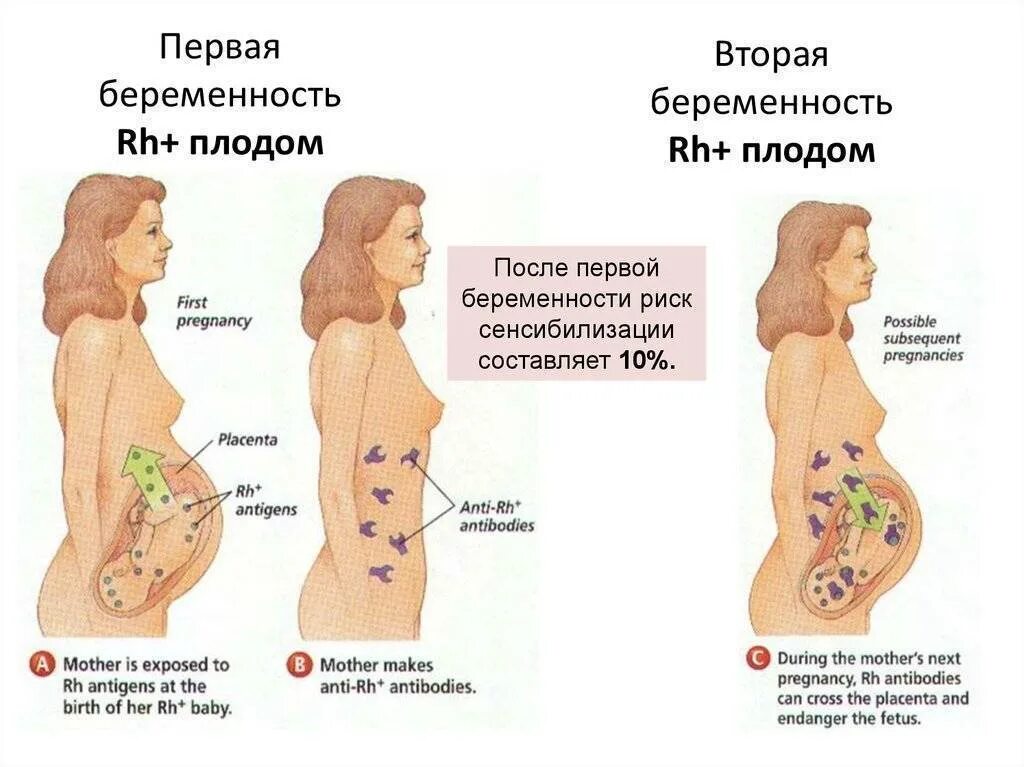 В третьем триместре тянет. Болит живот при беременности. Боли внизу живота при беременности. Болит низ живота при беременности.