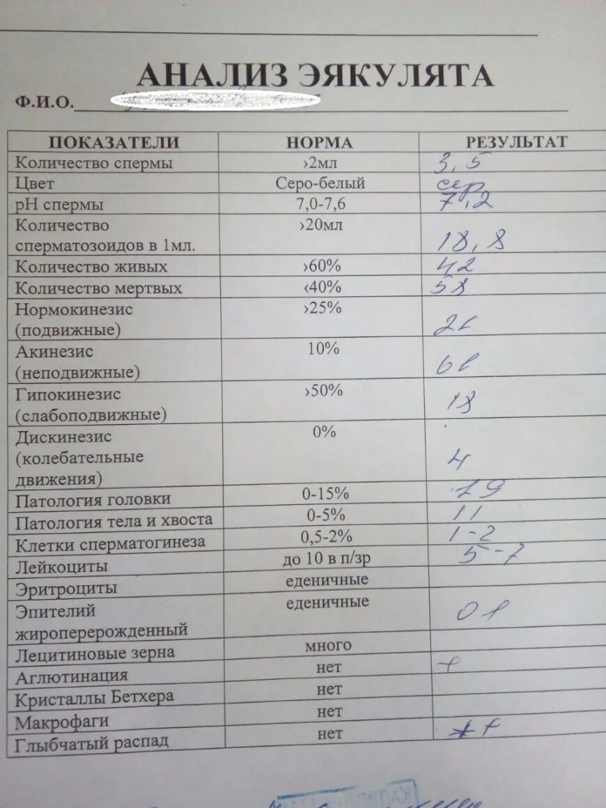 Куда Девать Сперму После Секса