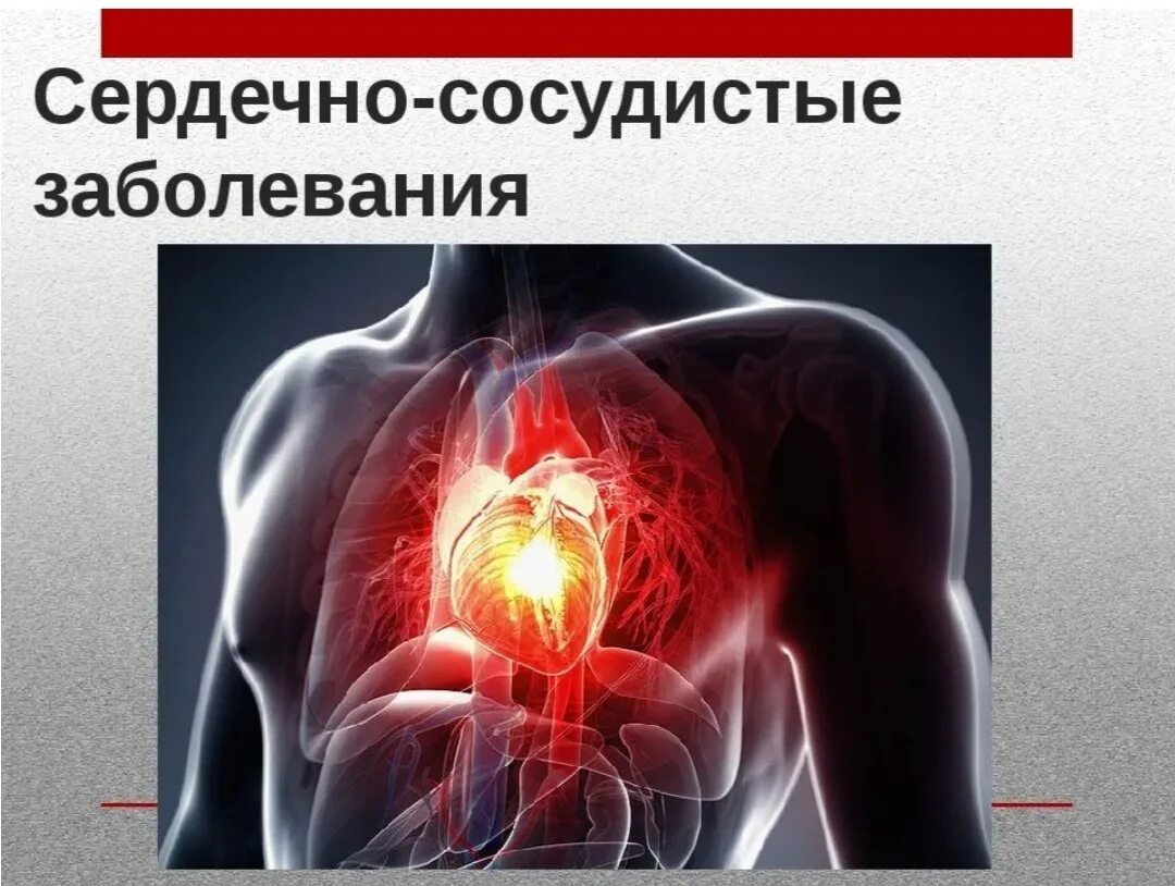 Заболевание нарушение кровообращения сосудистое