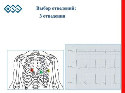Датчики холтера схема