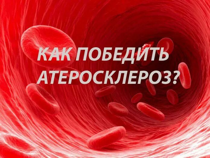 Пациент с атеросклерозом. Атеросклероз памятка. рекомендации по профилактике атеросклероза. атеросклероз школа для пациентов. атеросклероз профилактика заболевания.