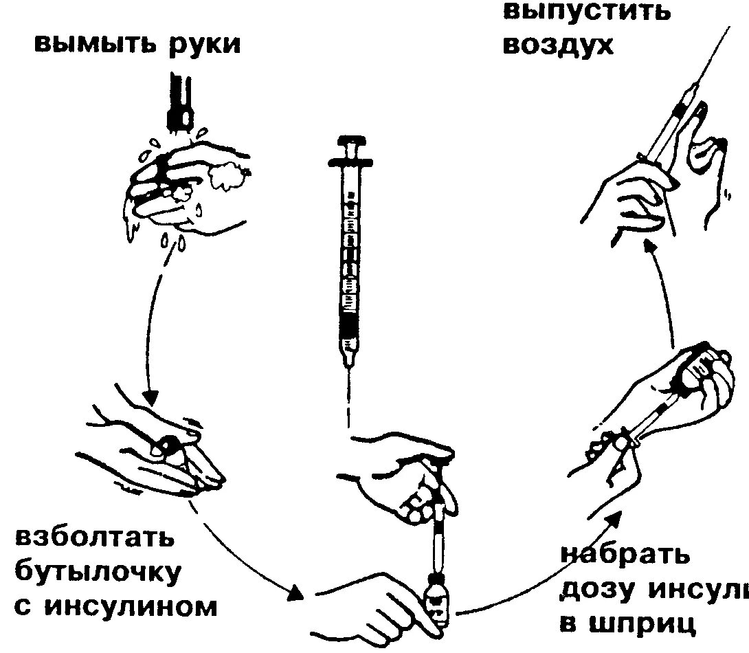 Подкожное Введение инсулина алгоритм. Набор инсулина в шприц алгоритм алгоритм. Алгоритм техники введения инсулина шприц. Укол не выпустив воздух