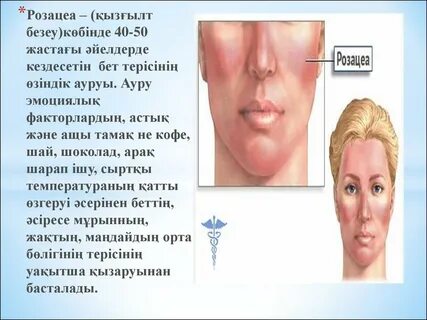 Ер адам сперматозоидты бірінен соң бірі жалайды