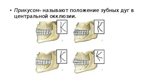 Прикусом называется