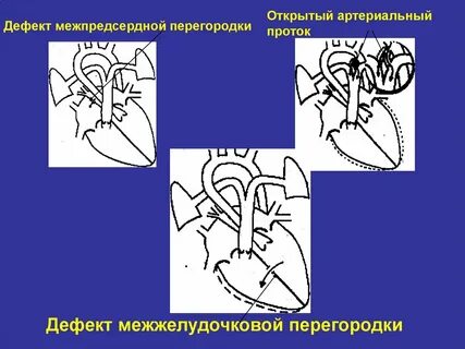 Дмпп оап