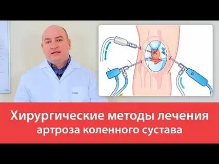 Современное лечение артрозов суставов