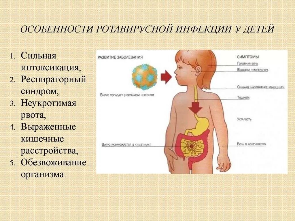 Инфекция рвота. Симтомы короновируса у де. ротавирусная инфекция. ротавирусная инфекция у детей. симптомы ротавируса у детей 7 лет.