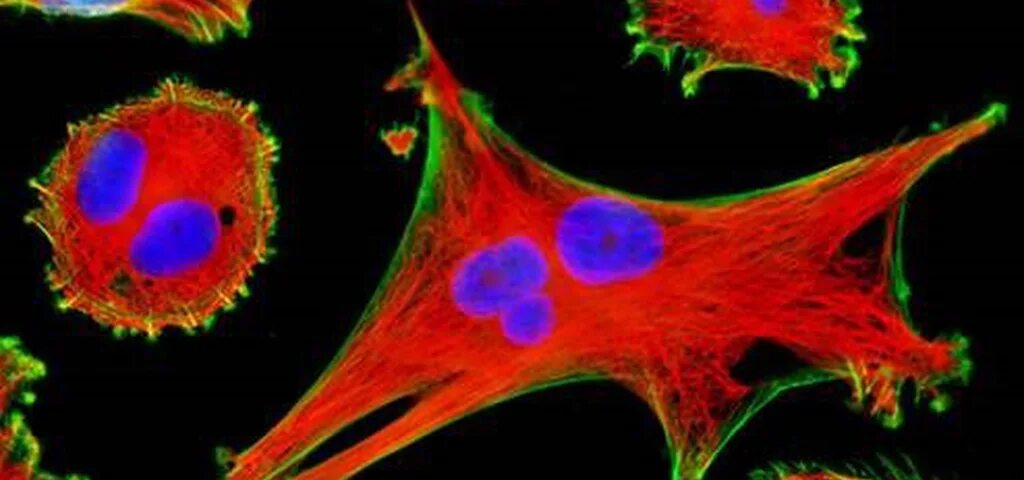 Цитоскелет микрофотография. Цитоскелет микрофотография. Наночастицы флуоресценция. Клетки ю. Эукариотическая клетка цитоскелет.