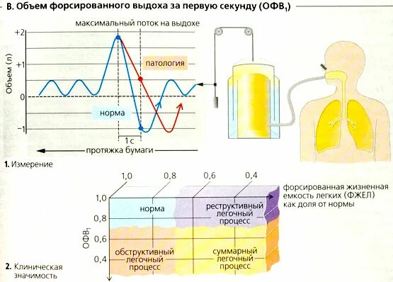 Емкость максимального выдоха. Объем фортированного вдоха. Объем форсированного выдоха. Обемь форсировано выдох. Объем форсированного выдоха за секунду.