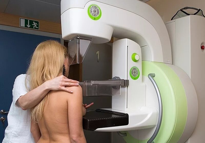 Маммография обязательно. Маммограф МЭИК” 5.0. Аппарат маммолога. Цифровая маммограмма.