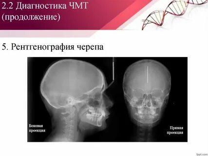С диагнозом черепно