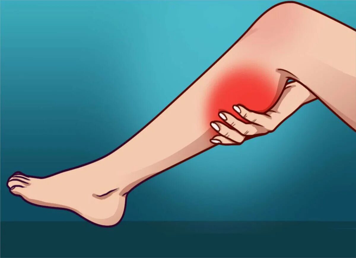 Судорога стоп лечение. Болезненные судороги в ногах. Судорога икроножной мышцы.