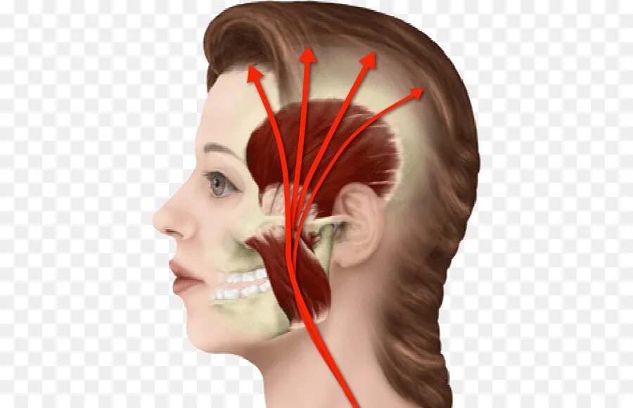 Миофасциальный болевой синдром ВНЧС. Миофасциальный болевой синдром мышц лица. Миофасциальный болевой синдром при ВНЧС. Миофасциальный болевой синдром в стоматологии.