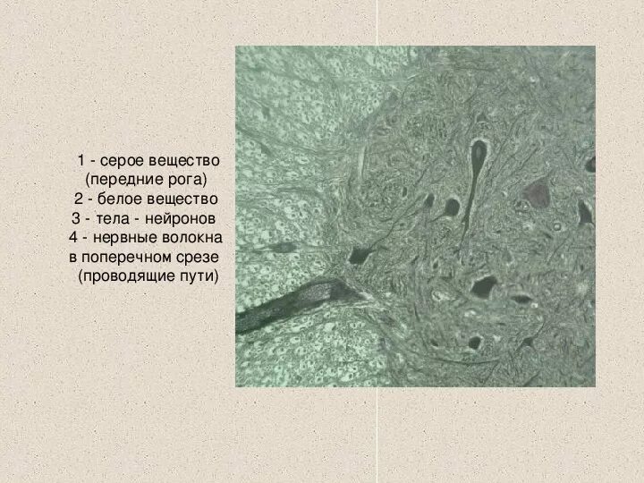 Выделения серого вещества. Нервные волокна белого вещества. Серое и белое вещество. Серое вещество нервной ткани. Серое вещество из.